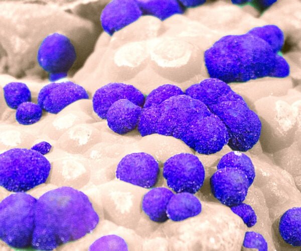 Blue and white rocks